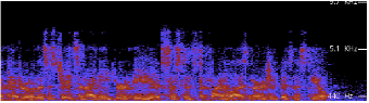 Spectrogram Analysis of ‘Normal’ Human Voice